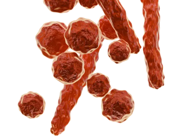 Mycoplasma hominis